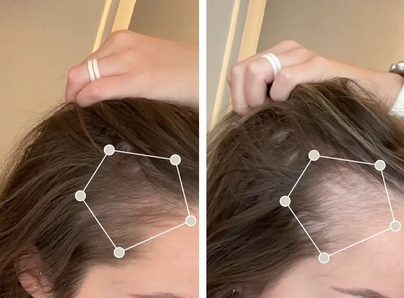 oma and me avant apres 2