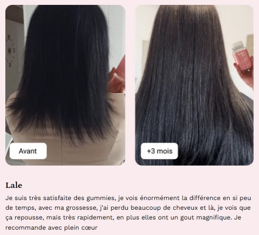 karacare avant apres lale