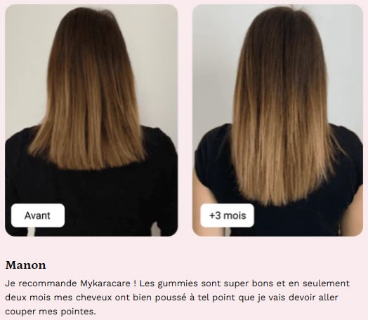 karacare avant apres manon