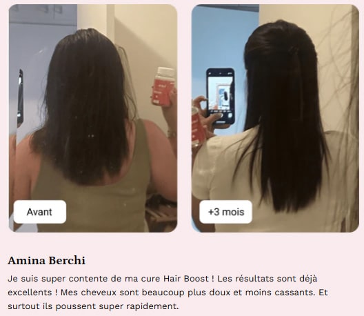 mykaracare avant apres amina