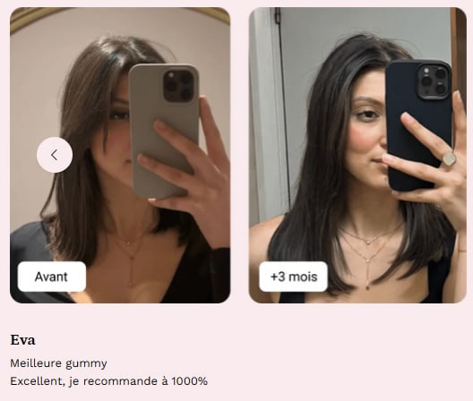 mykaracare avant apres eva