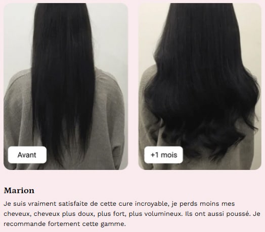 mykaracare avant apres marion